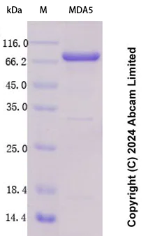 SDS-PAGE - Recombinant Human MDA5 Protein Standard (His tag) (AB323066)
