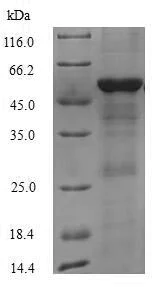 SDS-PAGE - Recombinant Human MDA5 protein (Tagged) (AB240773)