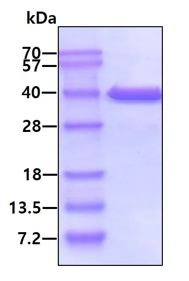SDS-PAGE - Recombinant Human MDH1 protein (His tag C-Terminus) (AB99244)