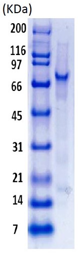 Recombinant Human MDM2 protein