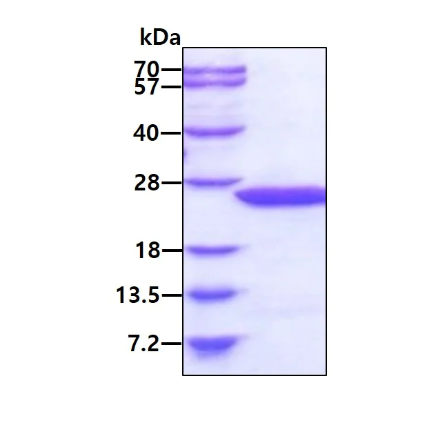 SDS-PAGE - Recombinant Human MDP1 protein (AB101631)