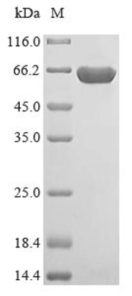 SDS-PAGE - Recombinant Human ME3 protein (His tag) (AB238230)