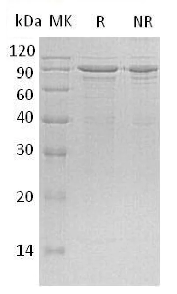 SDS-PAGE - Recombinant Human MeCP2 protein (His tag) (AB196070)