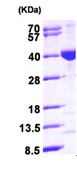SDS-PAGE - Recombinant Human MECR protein (AB99325), expandable thumbnail
