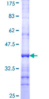 Recombinant Human MED13L protein