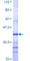 SDS-PAGE - Recombinant Human MED13L protein (AB153226)