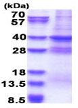 SDS-PAGE - Recombinant Human MED3 protein (denatured) (His tag N-Terminus) (AB180327)