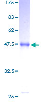 SDS-PAGE - Recombinant Human MED30 / TRAP25 protein (AB164823)