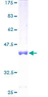 SDS-PAGE - Recombinant Human MED31 protein (AB162385), expandable thumbnail