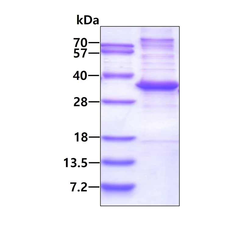 SDS-PAGE - Recombinant Human MED7 protein (His tag N-Terminus) (AB131673)