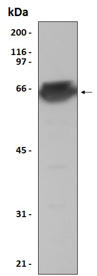 Western blot - Recombinant Human MEF2A protein (6x His tag C-Terminus) (AB204772)