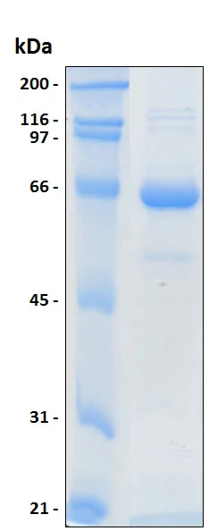 SDS-PAGE - Recombinant Human MEF2A protein (His tag) (AB204772)