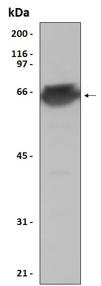 Western blot - Recombinant Human MEF2A protein (His tag) (AB204772)