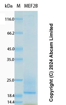 SDS-PAGE - Recombinant Human MEF2B Protein Standard (His tag) (AB323101)