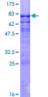 Recombinant Human MEF2C protein