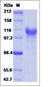 SDS-PAGE - Recombinant Human Megf10 protein (His tag) (AB276714), expandable thumbnail