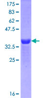 SDS-PAGE - Recombinant Human MEIS1 protein (GST tag N-Terminus) (AB112321)