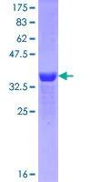 SDS-PAGE - Recombinant Human MEIS1 protein (GST tag N-Terminus) (AB112321)