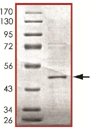 SDS-PAGE - Recombinant Human MEK1 (mutated K97A) protein (AB177259)
