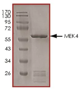 SDS-PAGE - Recombinant Human MEK4/MKK4 protein (Tagged) (AB268755)