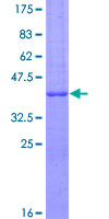 SDS-PAGE - Recombinant Human MelanA protein (AB114312), expandable thumbnail