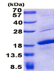 SDS-PAGE - Recombinant Human MelanA protein (AB157272)