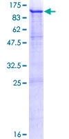 SDS-PAGE - Recombinant Human Melanoma gp100 protein (AB132146)