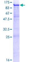 SDS-PAGE - Recombinant Human Melanoma gp100 protein (GST tag N-Terminus) (AB132146)