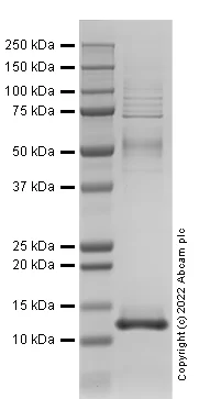 SDS-PAGE - Recombinant Human Melanoma Inhibitory Activity (MIA) Protein (AB290078)