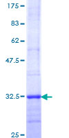 Recombinant Human Melatonin Receptor 1A/MTNR1A protein