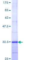 SDS-PAGE - Recombinant Human Melatonin Receptor 1A/MTNR1A protein (AB114688)