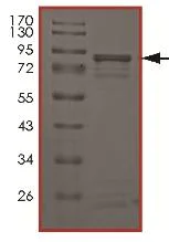 SDS-PAGE - Recombinant human MELK (mutated T460M) protein (AB179957)