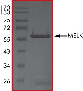 SDS-PAGE - Recombinant human MELK protein (AB102551)