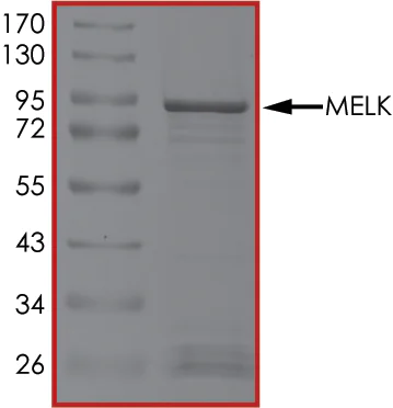 SDS-PAGE - Recombinant human MELK protein (Active) (AB204155)