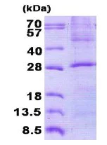 SDS-PAGE - Recombinant Human Membrin protein (denatured) (His tag N-Terminus) (AB140561)