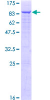 SDS-PAGE - Recombinant Human Menin protein (AB152527)