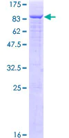SDS-PAGE - Recombinant Human Menin protein (AB152527)