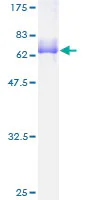 SDS-PAGE - Recombinant Human MEOX 2 protein (GST tag N-Terminus) (AB114829)