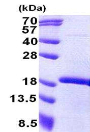 SDS-PAGE - Recombinant Human MEOX2 protein (His tag N-Terminus) (AB167892)