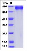 SDS-PAGE - Recombinant Human Meprin beta protein (His tag) (AB276308), expandable thumbnail