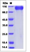 SDS-PAGE - Recombinant Human Meprin beta protein (His tag) (AB276308)