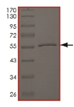 SDS-PAGE - Recombinant human MERTK (mutated A708S) protein (AB167957)