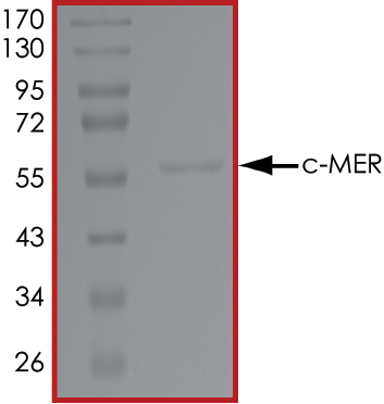 SDS-PAGE - Recombinant human MERTK protein (AB72490), expandable thumbnail