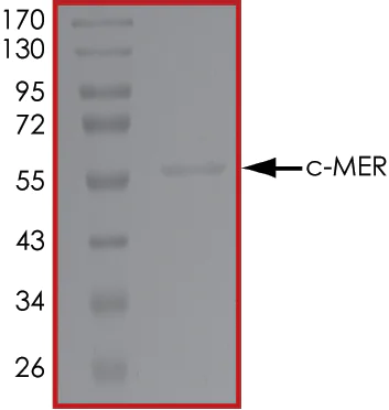 SDS-PAGE - Recombinant human MERTK protein (AB72490)
