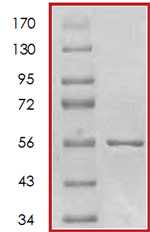 SDS-PAGE - Recombinant human MERTK protein (AB72490), expandable thumbnail