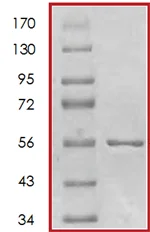 SDS-PAGE - Recombinant human MERTK protein (AB72490)