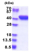 SDS-PAGE - Recombinant Human MESDC1 protein - BSA and Azide free (AB180334), expandable thumbnail