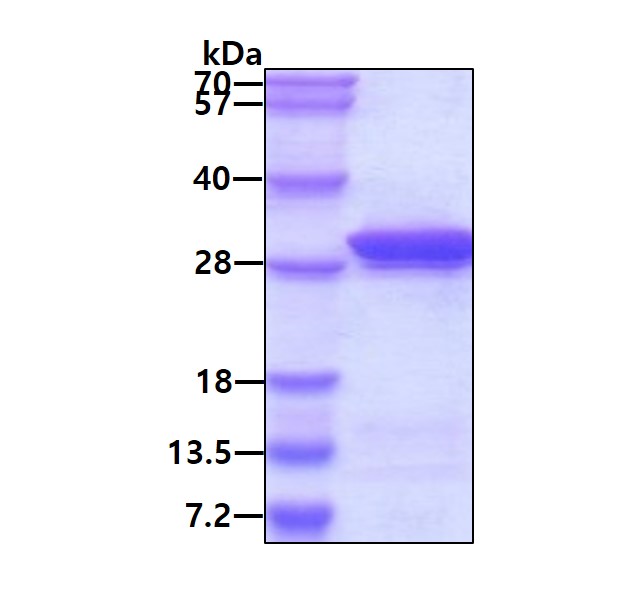 SDS-PAGE - Recombinant Human MESDC2 protein (AB104671), expandable thumbnail