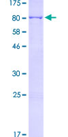 Recombinant Human Mesothelin protein