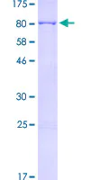 SDS-PAGE - Recombinant Human Mesothelin protein (AB153062)